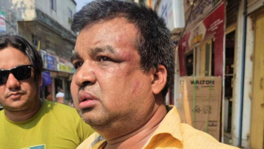 ভ্যাট কর্মকর্তাকে বৈদ্যুতিক খুঁটিতে বেঁধে মারধর ‘ভুয়া’ ভেবে , ভাঙল হাত