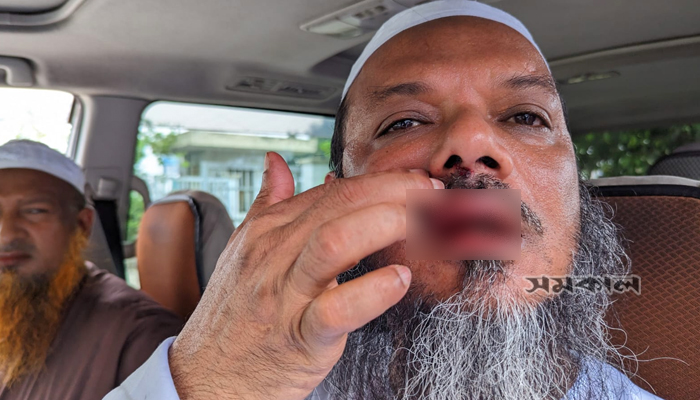 ফয়জুল করিমের ওপর হামলা হাতপাখার মেয়র প্রার্থী 